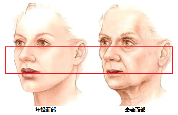 辽宁杏林整形外科医院：为啥你比同龄人显老?这3处中面部凹陷别忽视!
